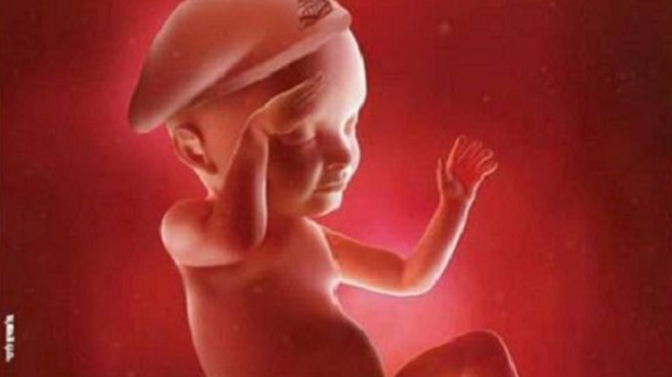 : Ultrazvuk zobrazuje plod dítěte jako salutujícího vojáka